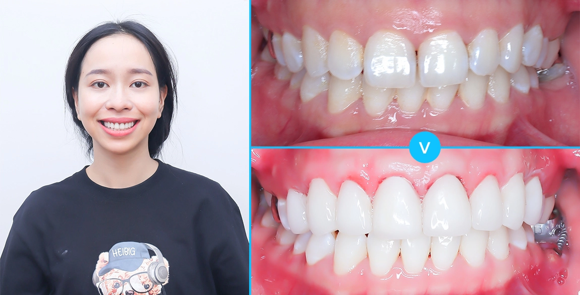 Trần Thị Kim Ngân