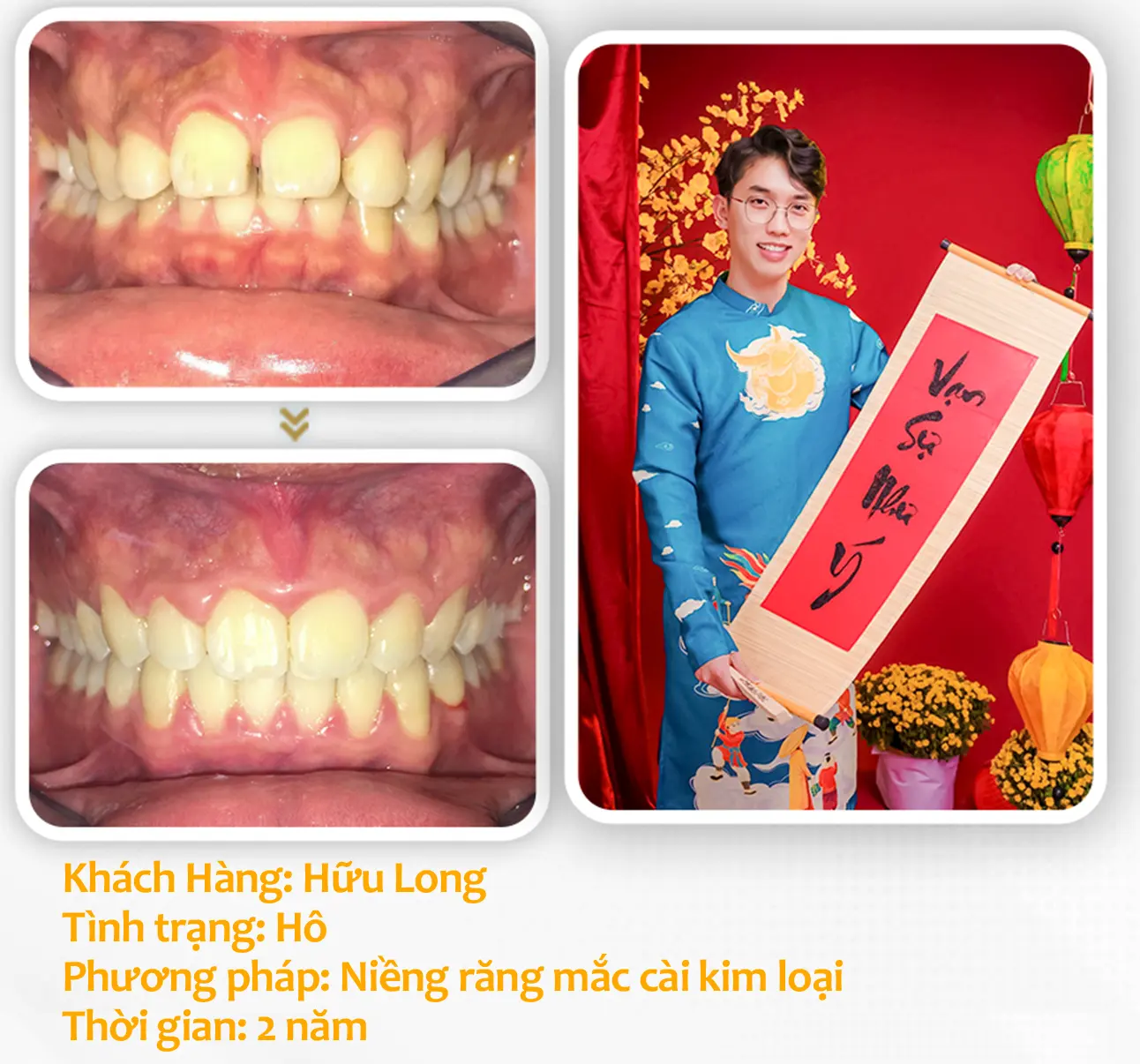 aligndental