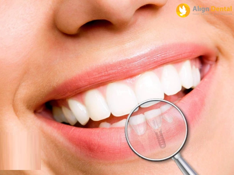 Mis C1 có nhiều ưu điểm nổi trội mang đến cho khách hàng