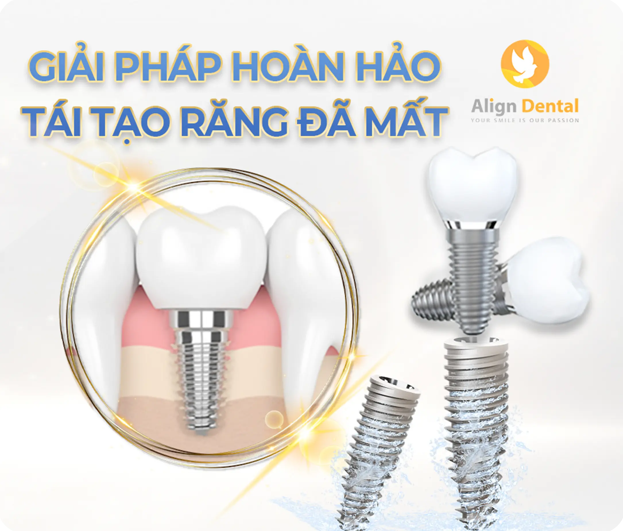 aligndental
