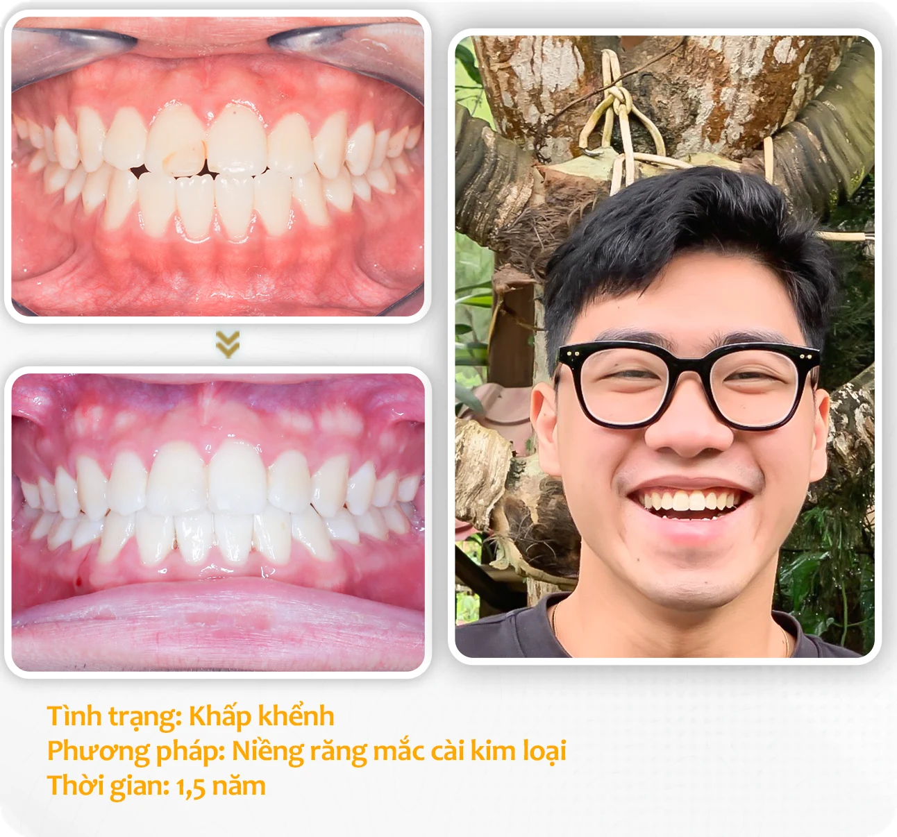 aligndental