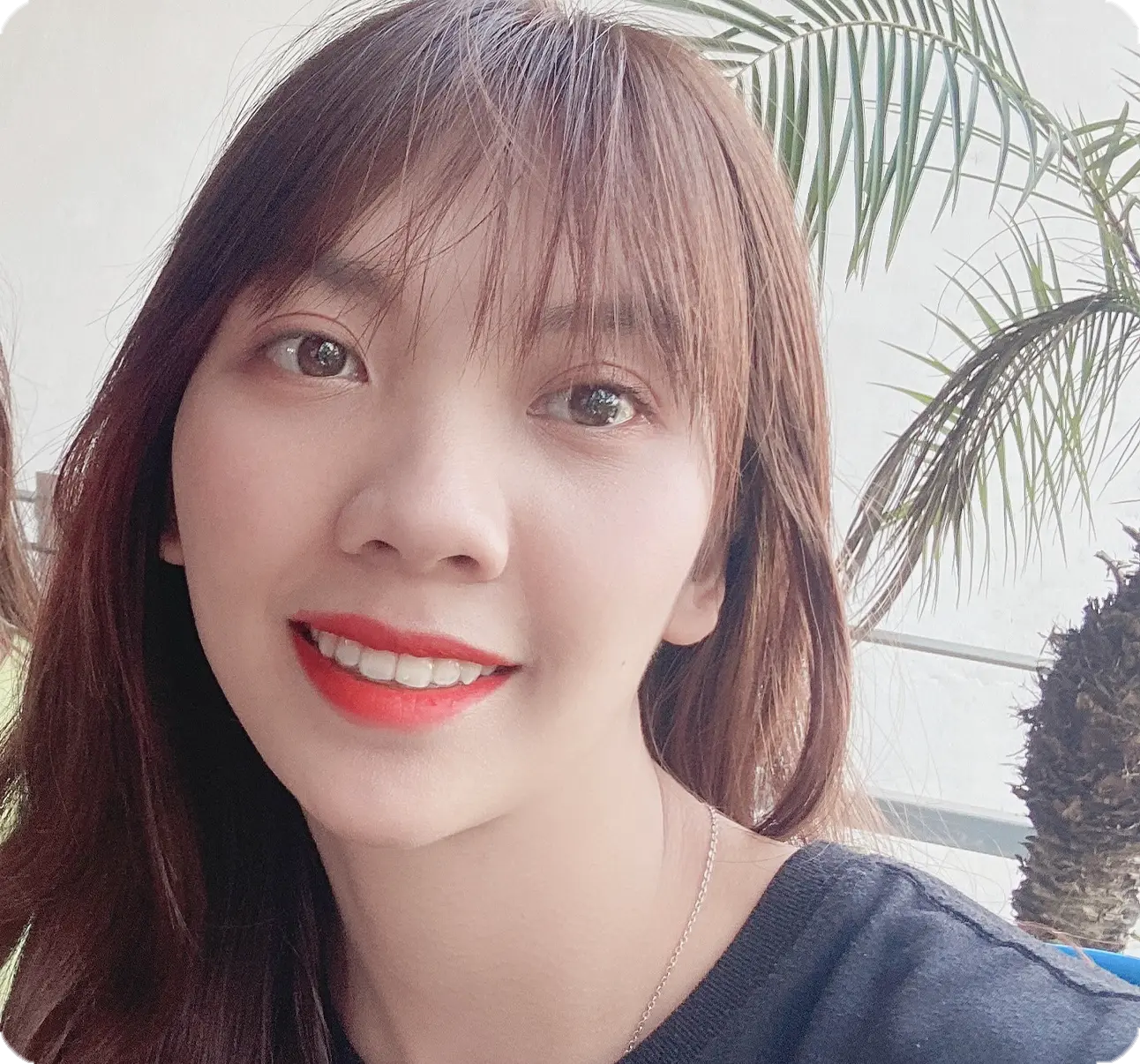 aligndental