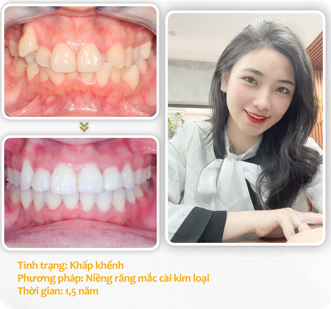 aligndental