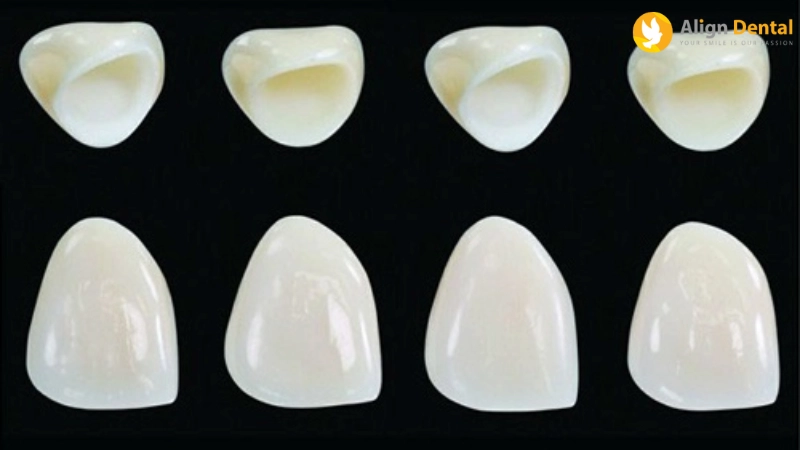 răng sứ venus