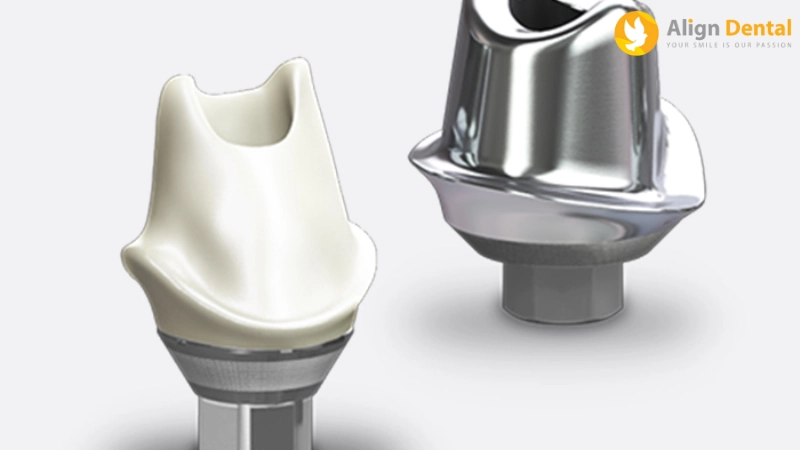 abutment là gì