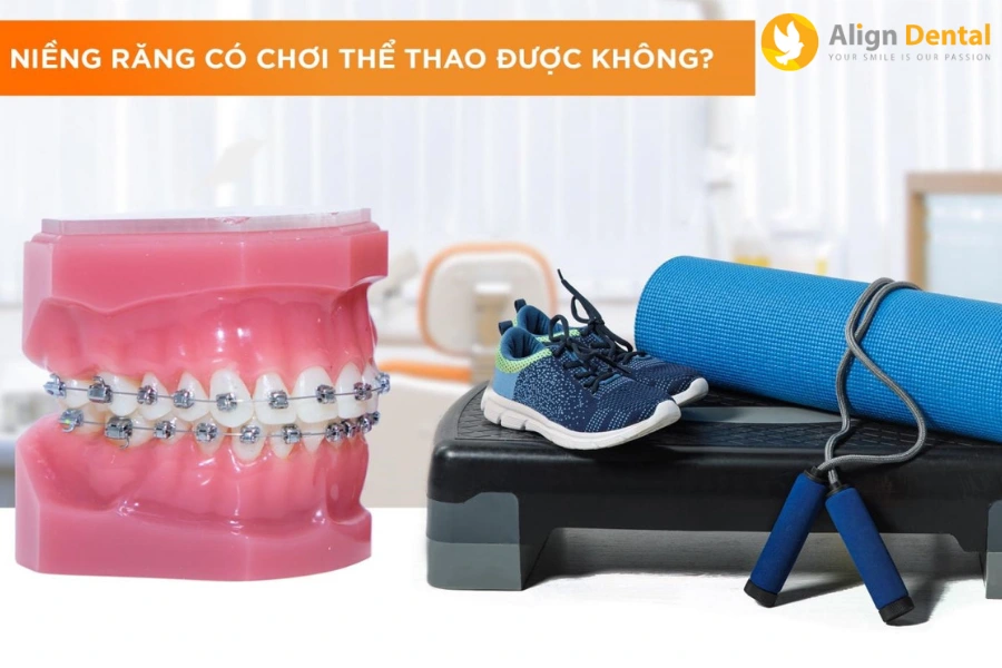Niềng Răng Có Chơi Thể Thao Được Không? Cần Lưu Ý Gì?