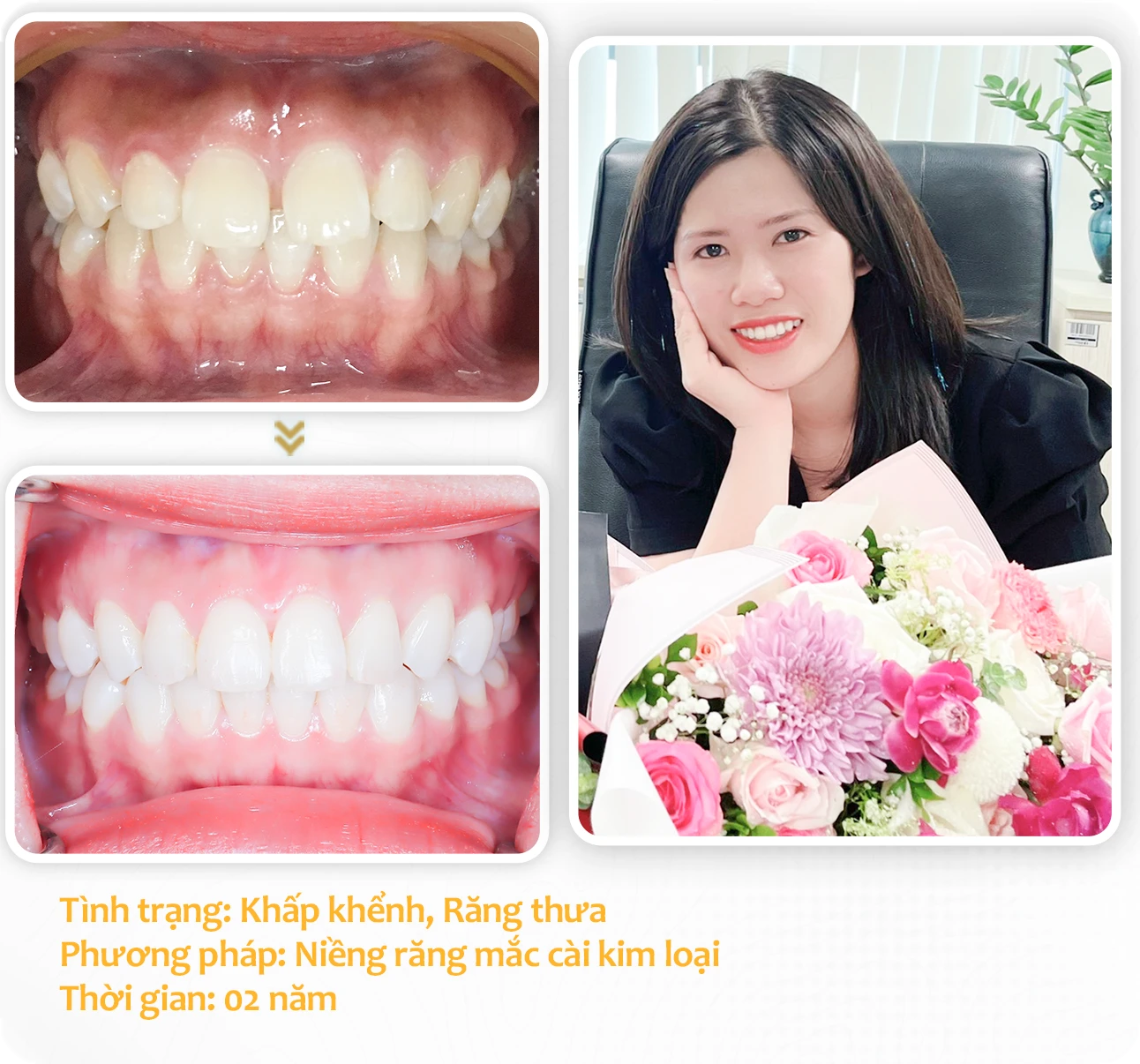 aligndental