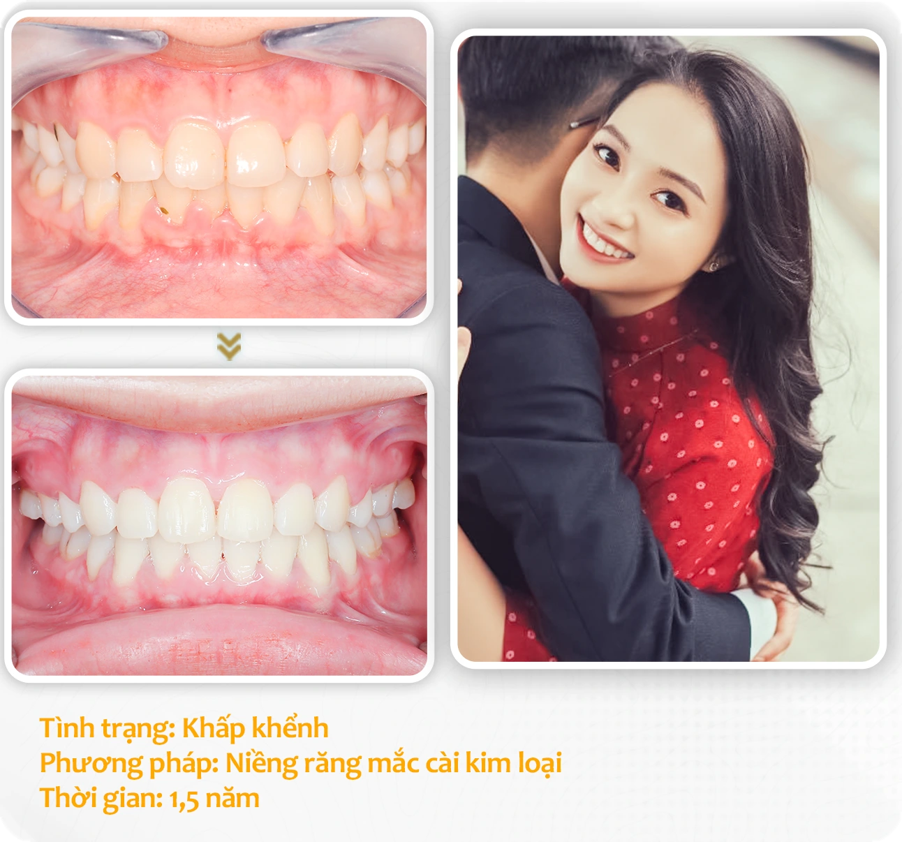 aligndental