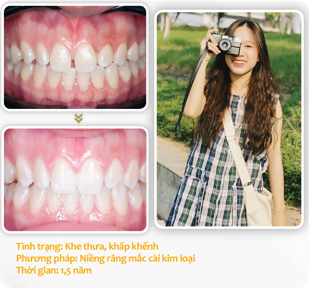 aligndental