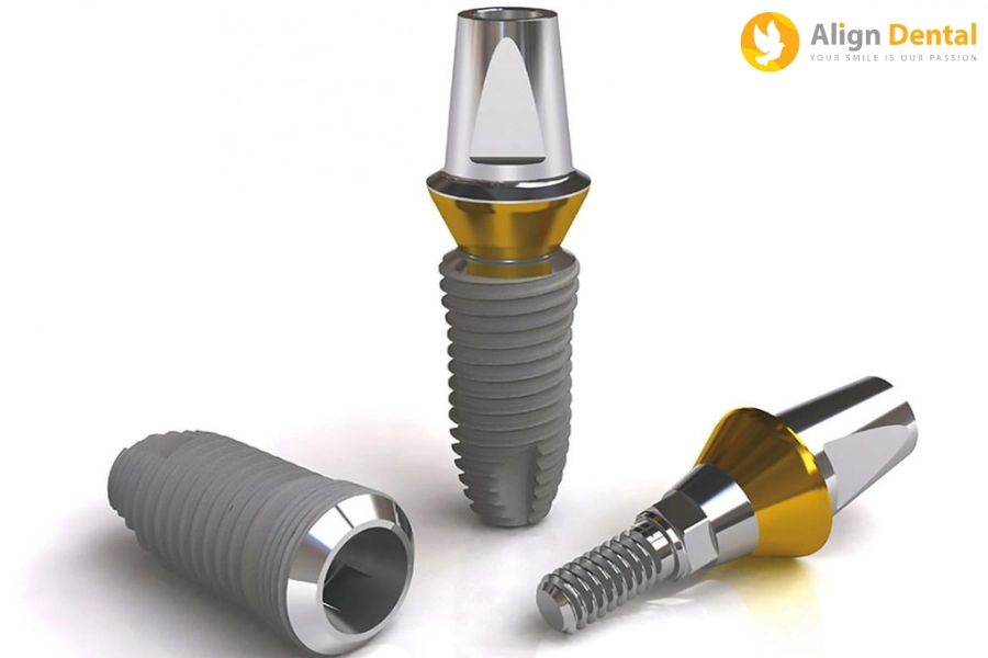Trồng Răng Implant Loại Nào Tốt Và Phổ Biến Nhất Hiện Nay?