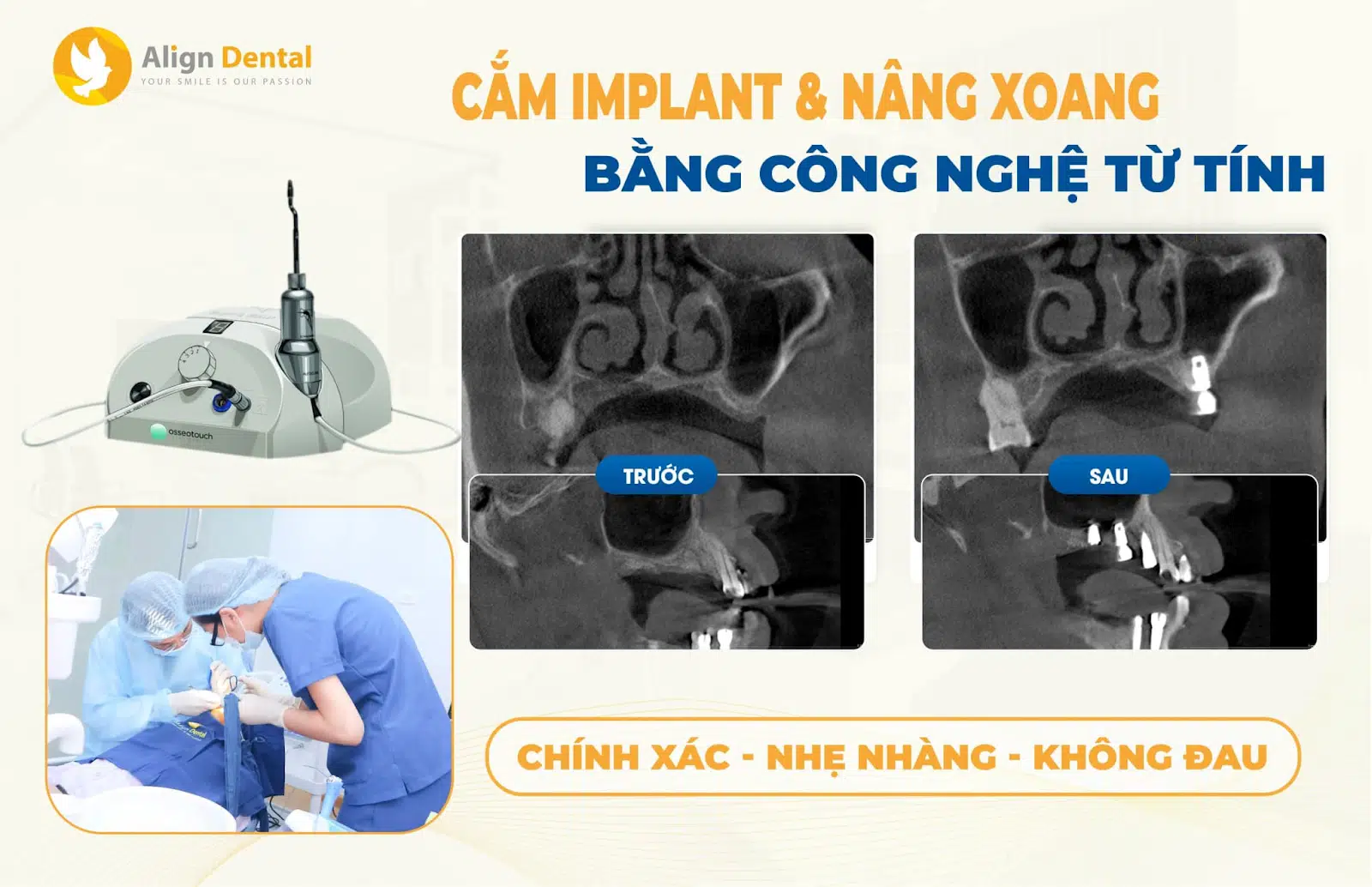 trồng răng implant
