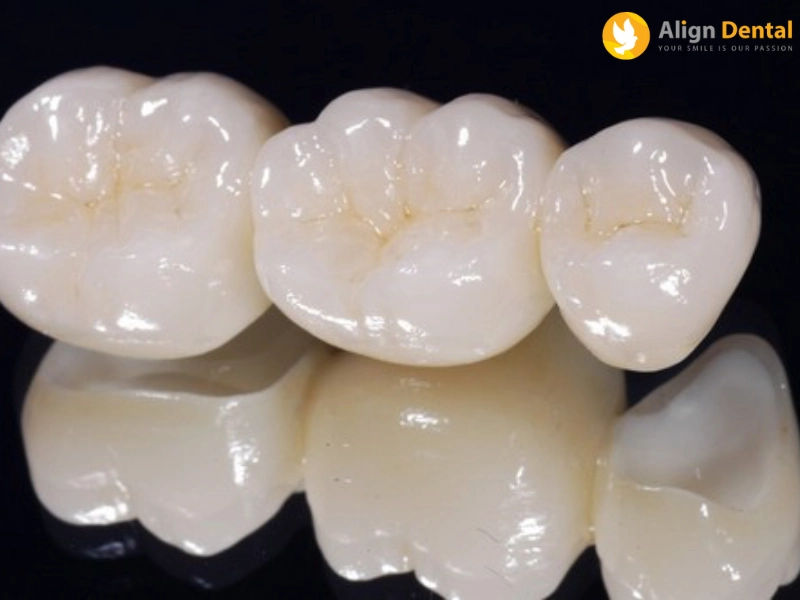 răng sứ thẩm mỹ