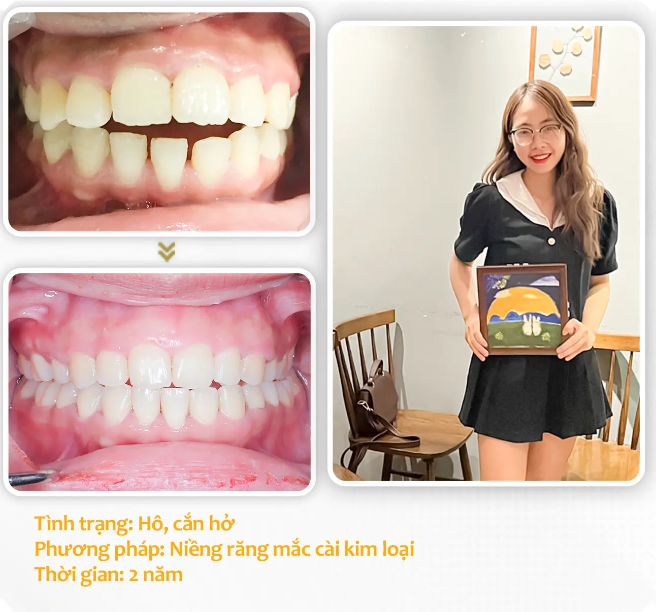 aligndental