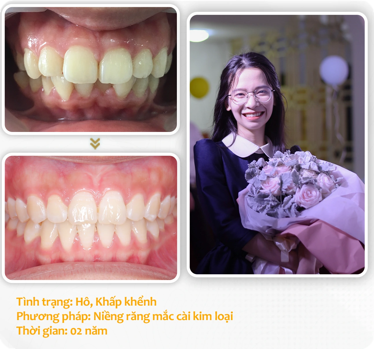 aligndental