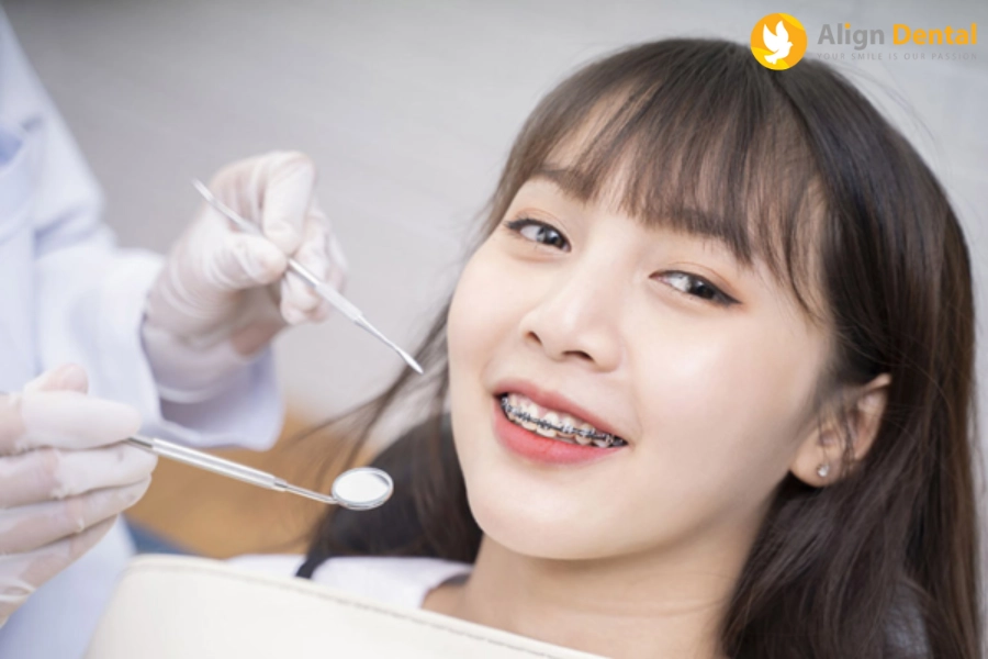 #17 Tuổi Niềng Răng Bao Nhiêu Tiền? Nên Sử Dụng Phương Pháp Nào