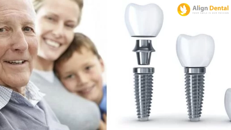 trồng răng implant cho người già