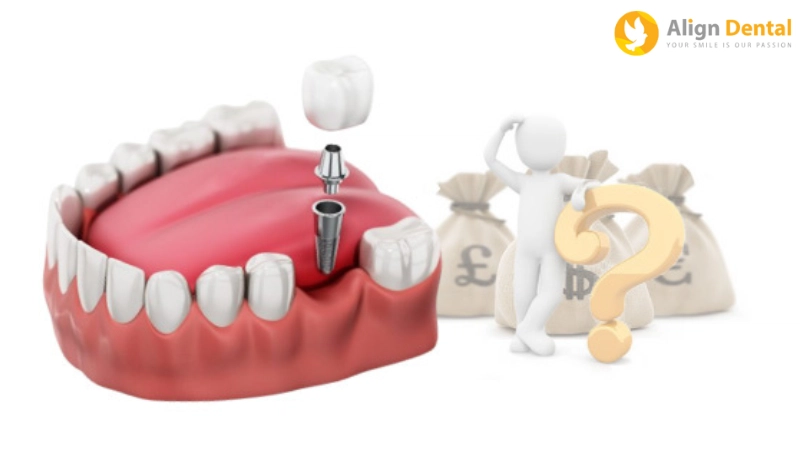 nhược điểm của trồng răng implant