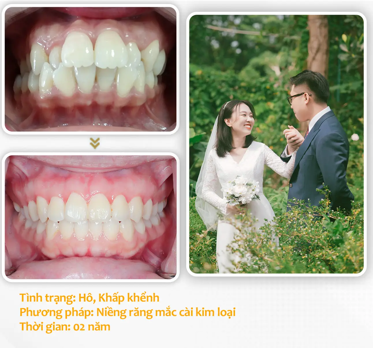 aligndental