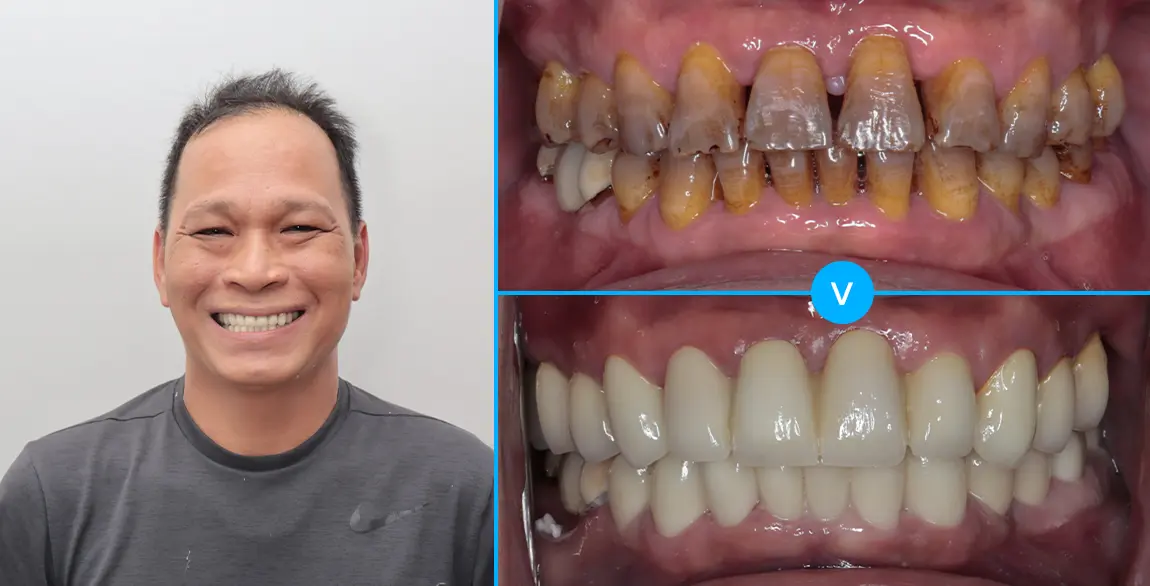Trương Viết Cương