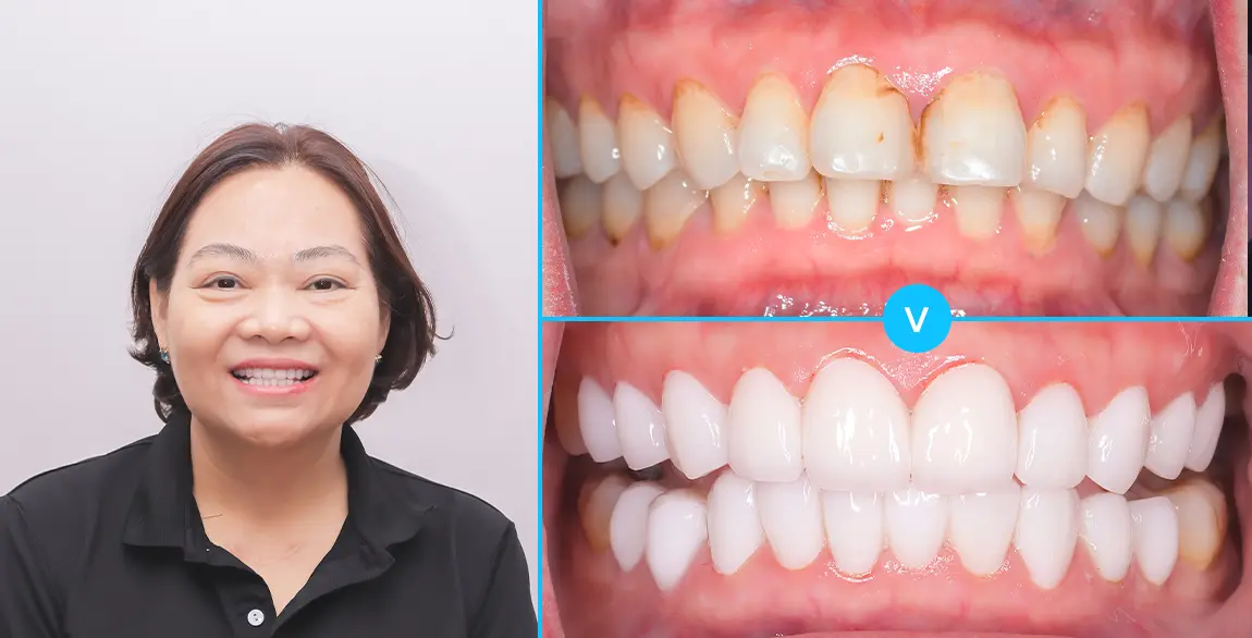 Nguyễn Thị Ánh Loan