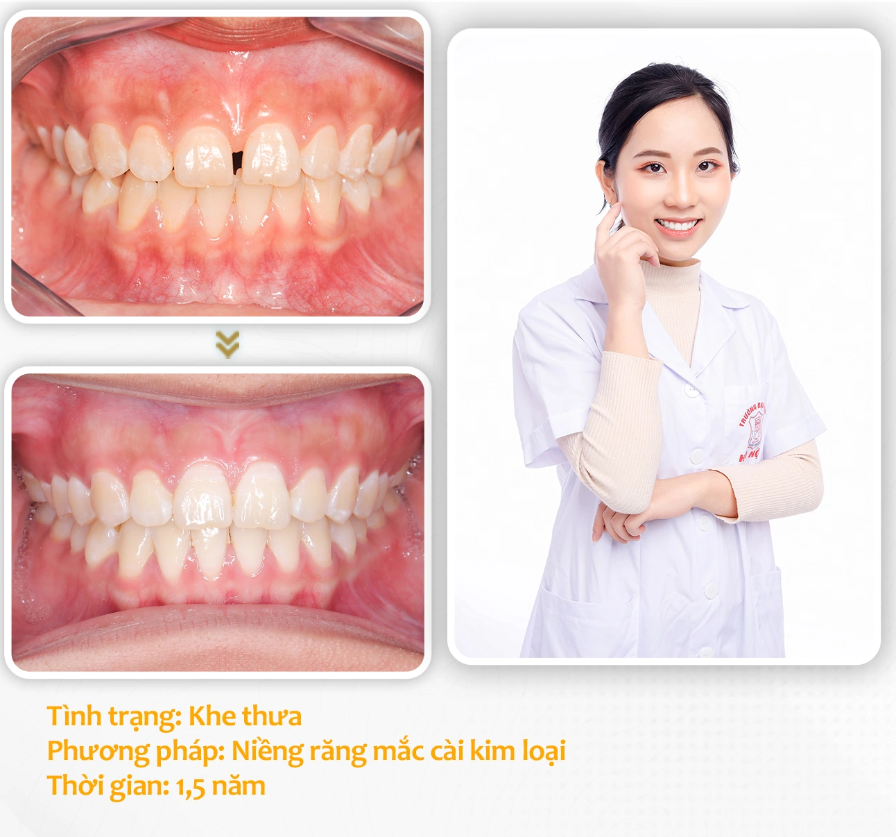 aligndental