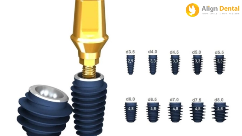 trồng răng implant loại nào tốt