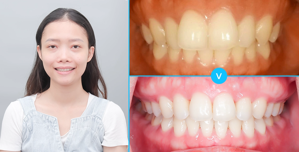 Phương Vân