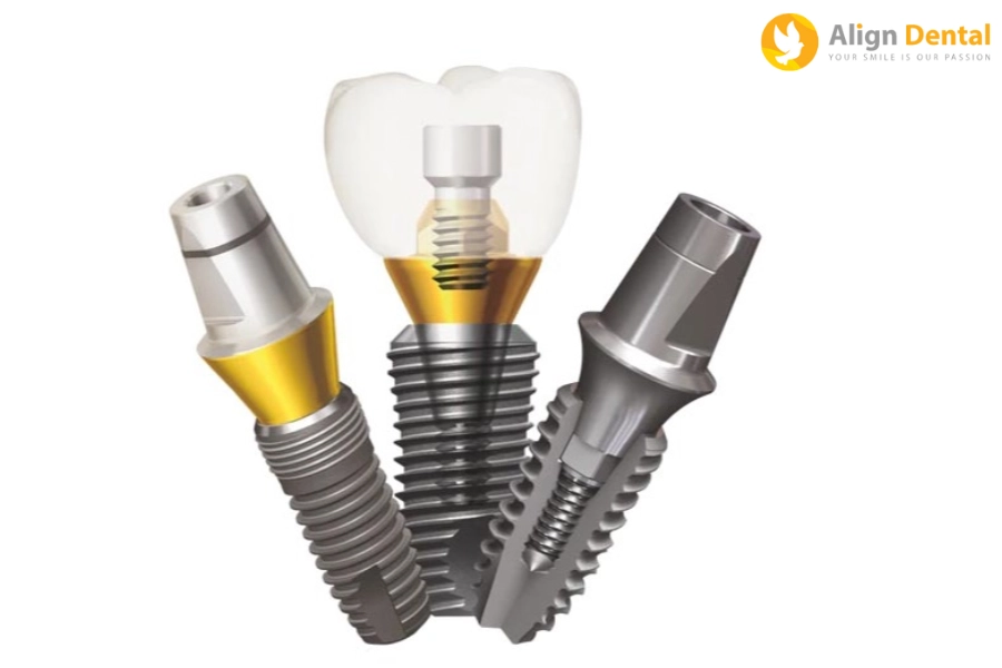 Trụ Implant Dentium Mỹ Là Gì? Ưu Điểm Và Giá Trụ Là Bao Nhiêu?