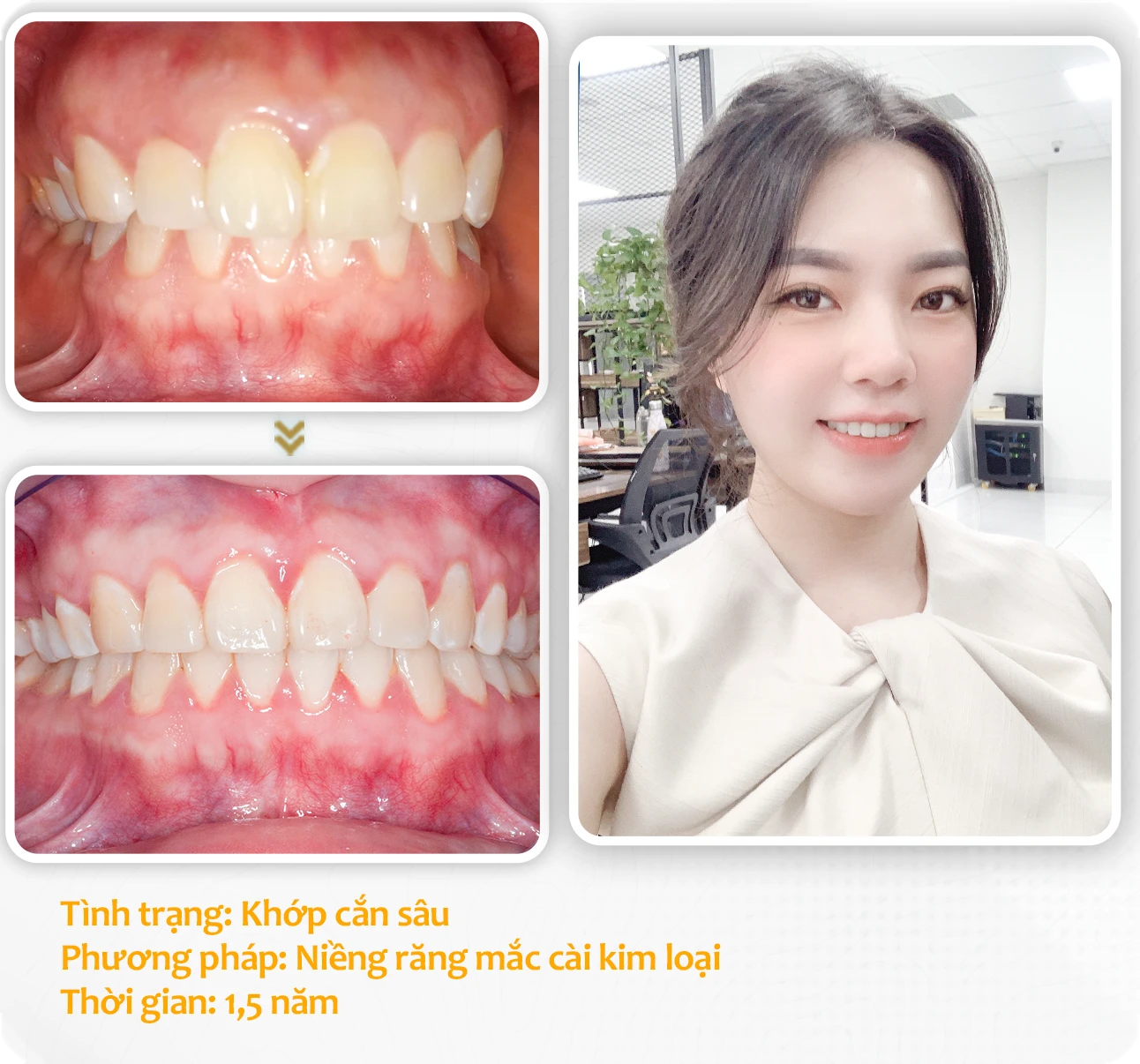 aligndental