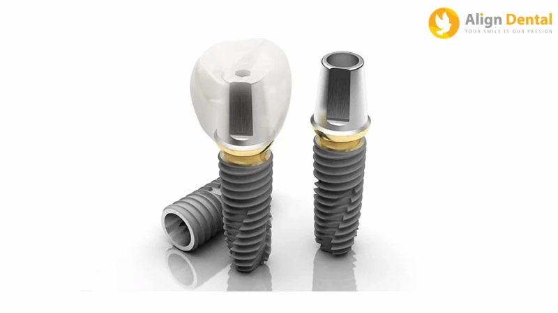 Implant Đức