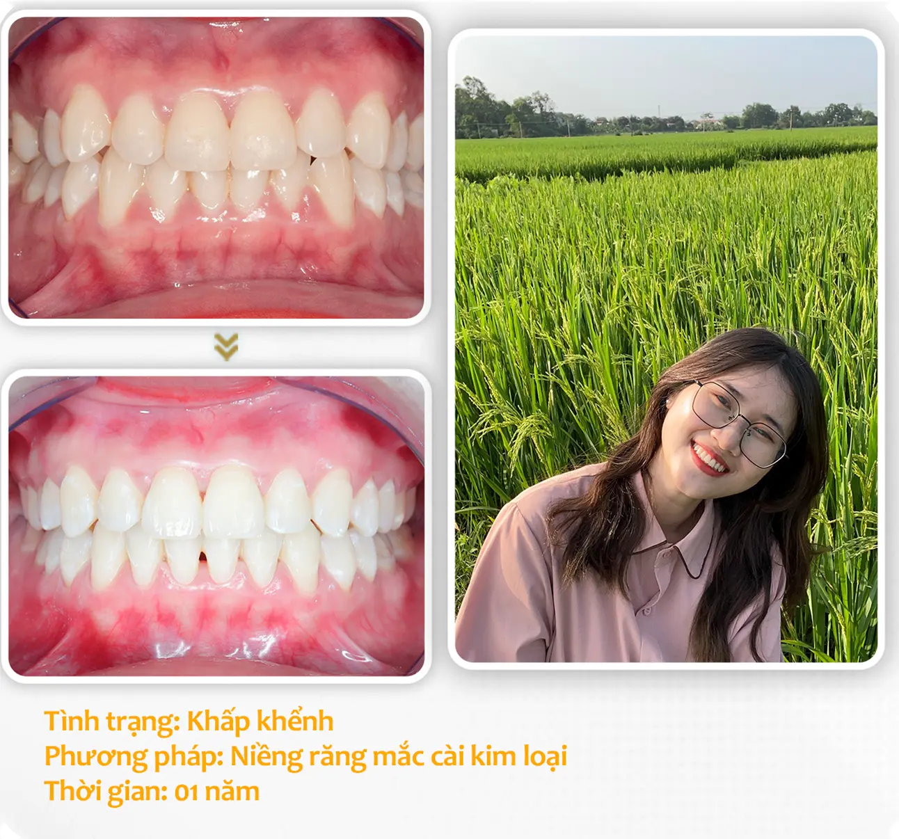 aligndental