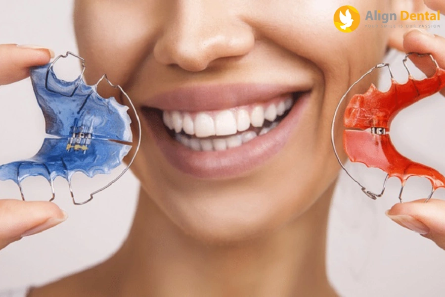 Tìm Hiểu Các Loại Hàm Duy Trì Sau Niềng Răng Phổ Biến Nhất