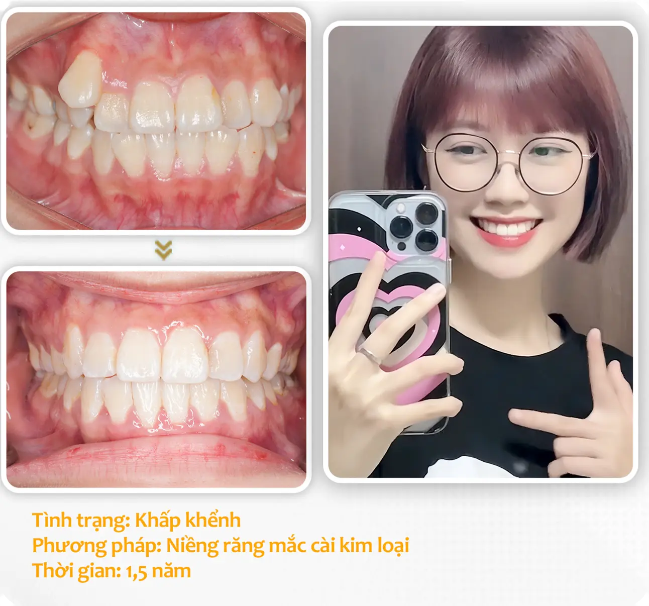 aligndental