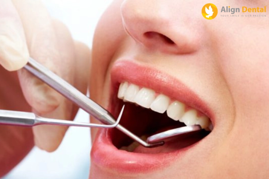 Nhổ Răng Bao Lâu Thì Trồng Lại Được? Phương Pháp Nào Hiệu Quả?