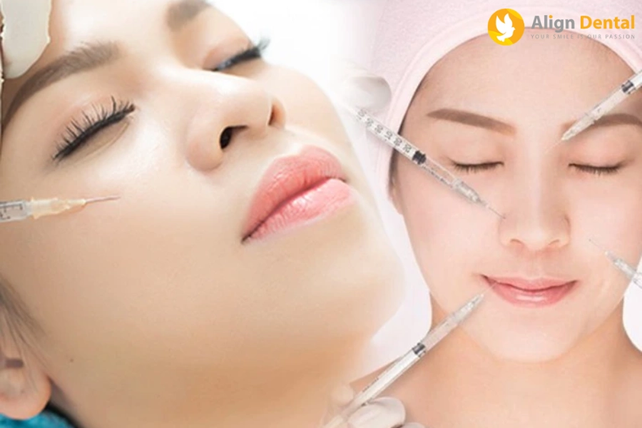 Niềng Răng Có Tiêm Filler Được Không? [Giải Đáp Từ Chuyên Gia]