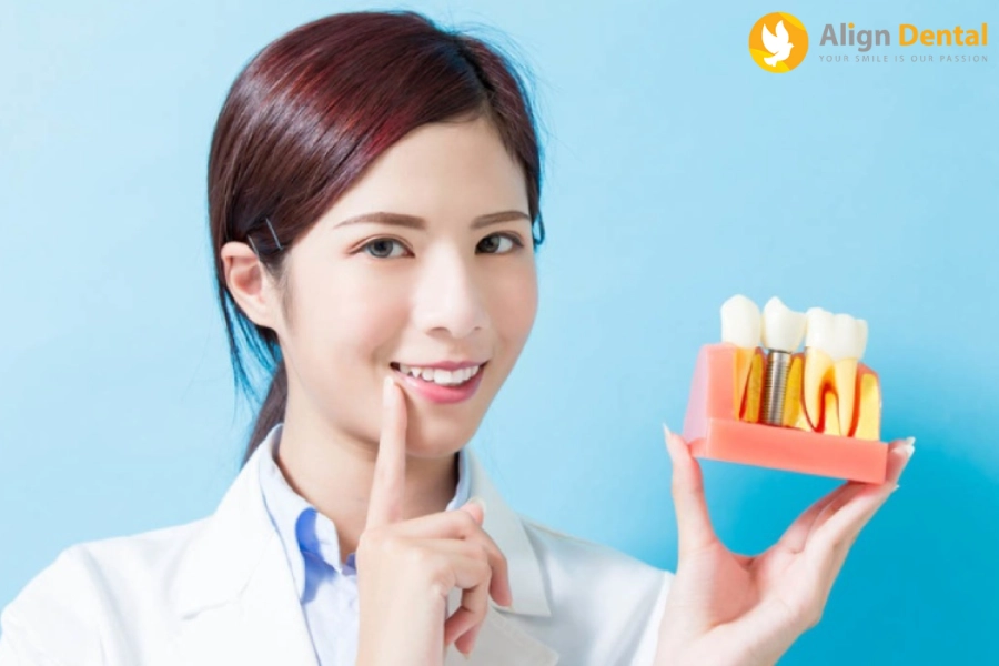 [Hướng Dẫn] Cách Chăm Sóc Răng Sau Khi Cắm Implant