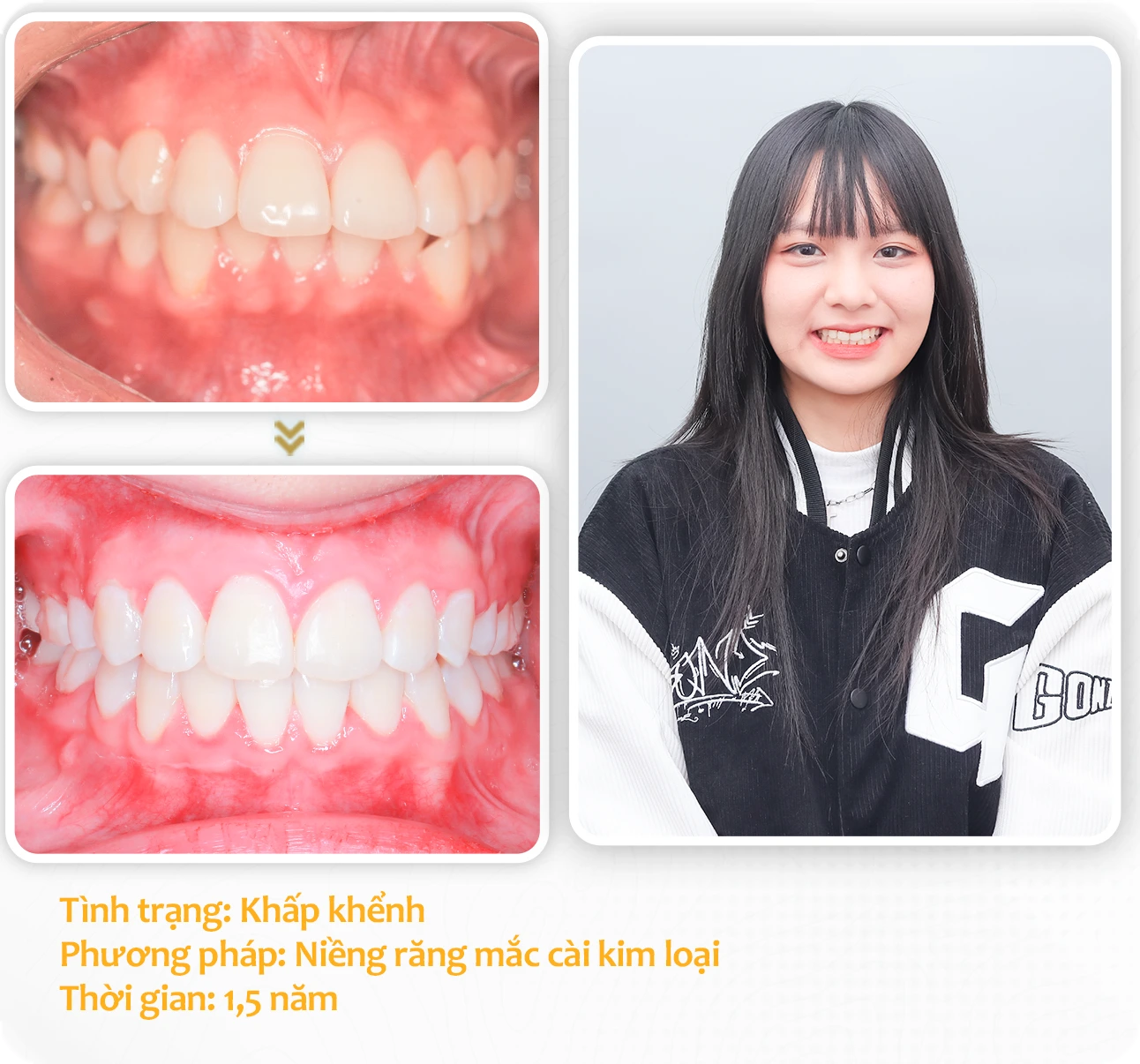 aligndental