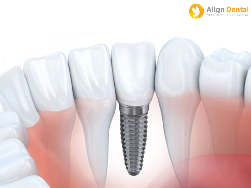Trụ Biotem Hàn Quốc có nhiều ưu điểm nổi bật