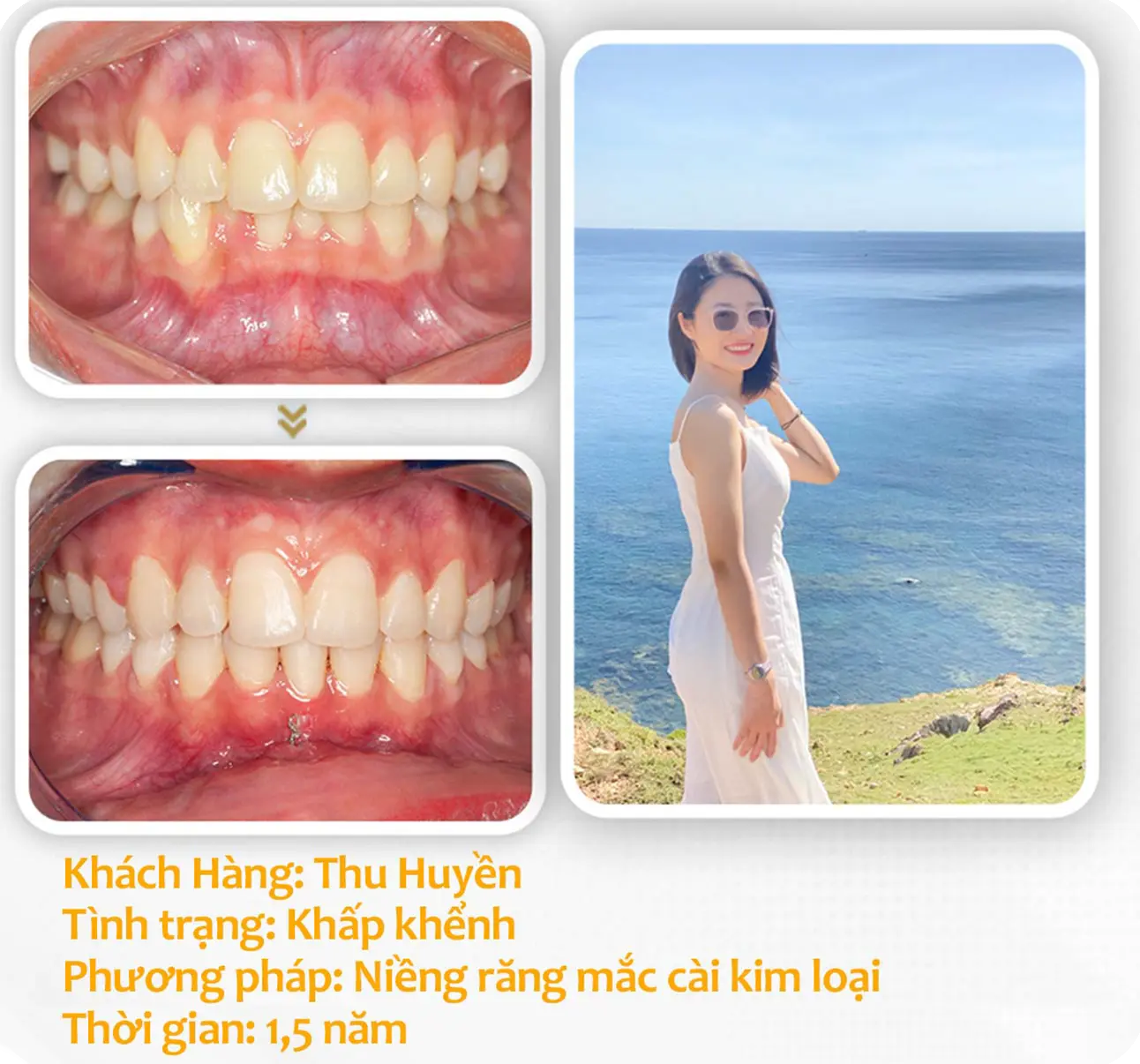 aligndental