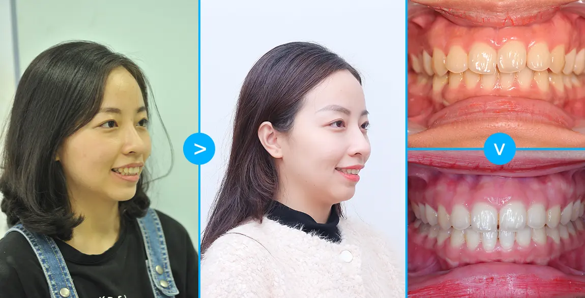 aligndental